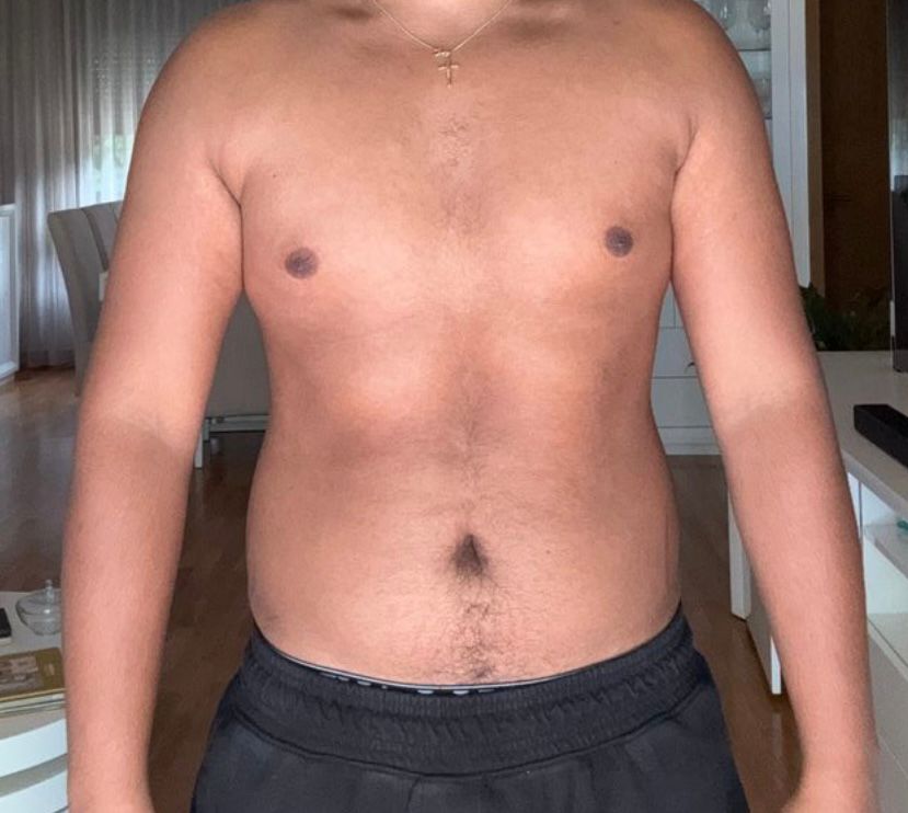 Antes