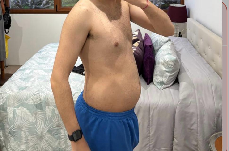 Antes